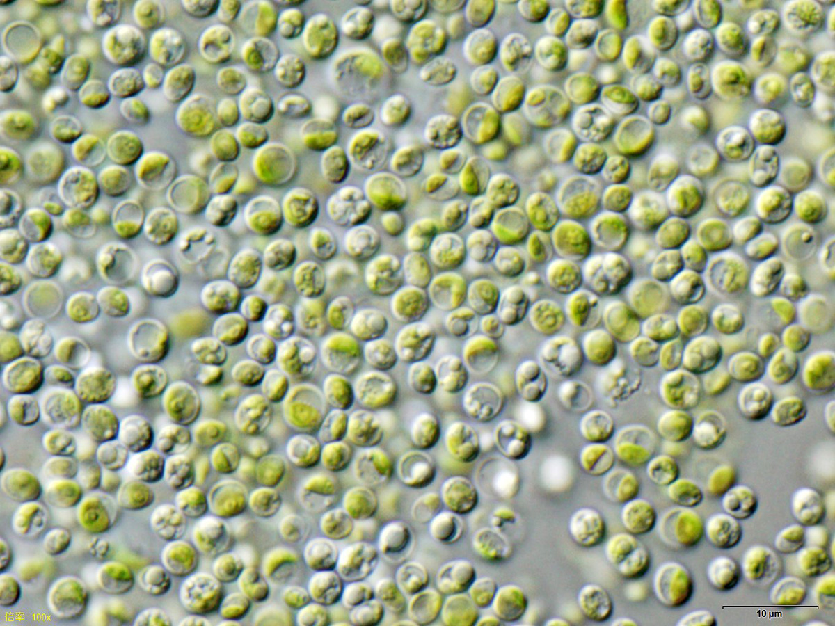 Chlorella_vulgaris_NIES2170